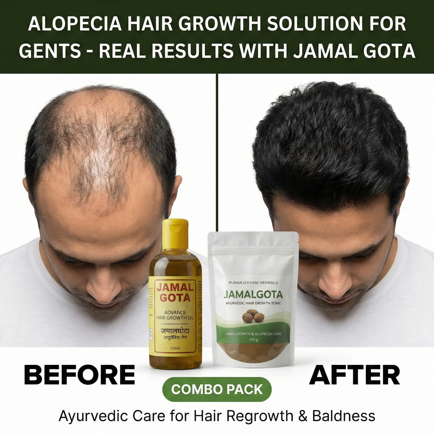 Advanced Jamalgota Herbal Hair Oil-100% Intense Hair Care
